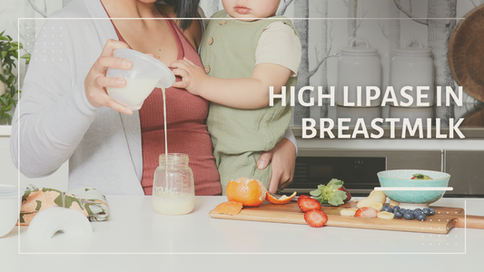 High Lipase in Breastmilk